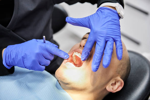 Best Emergency Wisdom Tooth Extraction in Stone Park, IL